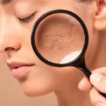 Cold Weather Skincare Mistakes That Are Drying Out Your Skin