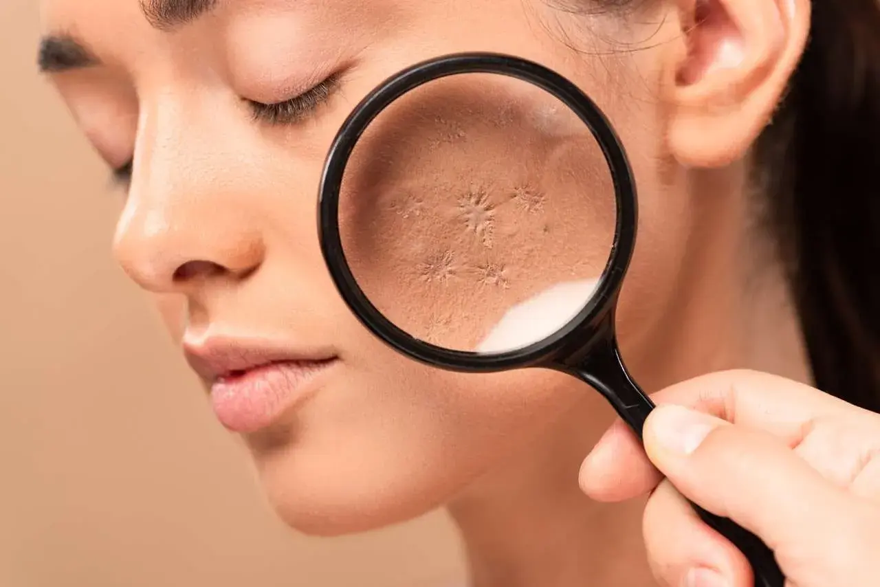 Cold Weather Skincare Mistakes That Are Drying Out Your Skin
